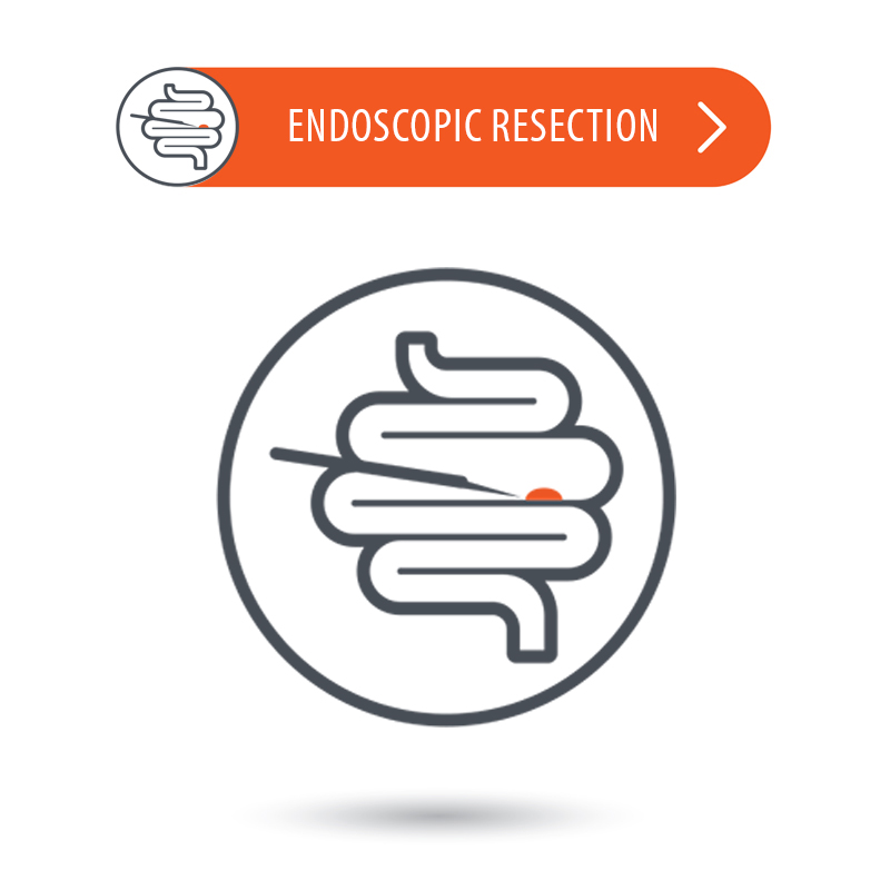 Endoscopic Mucosal Resection